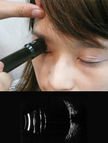 초음파 검사2(B-scan)